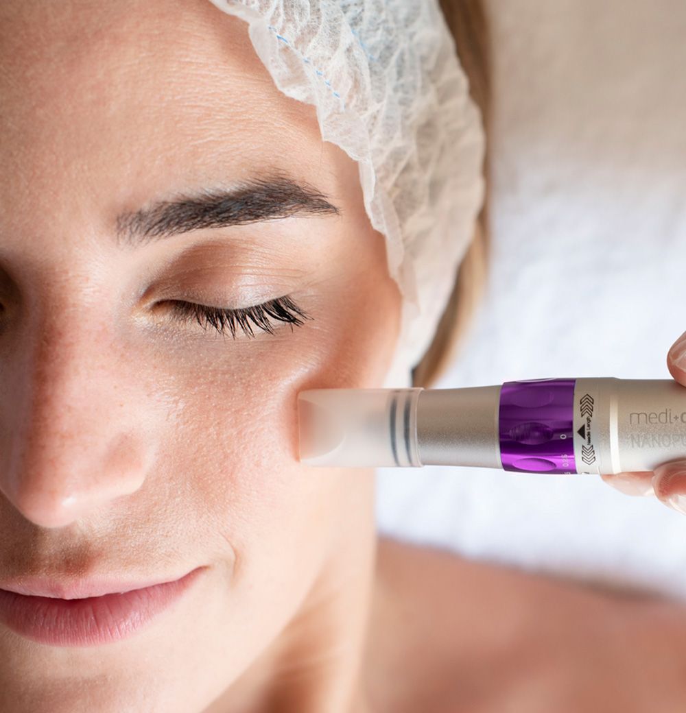 Mikroterapija - mikroadatinė sistema su Nanopore