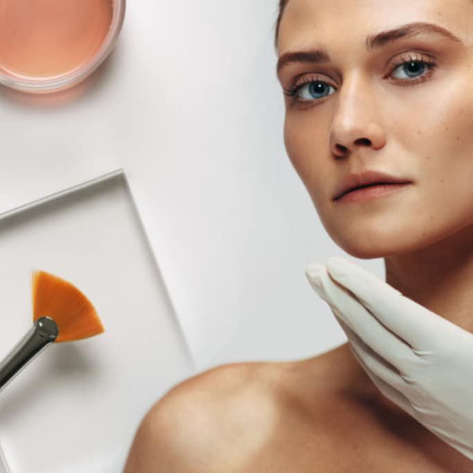 MELA – naujausia ir inovatyviausia procedūra hyperpigmentacijos problemai spręsti