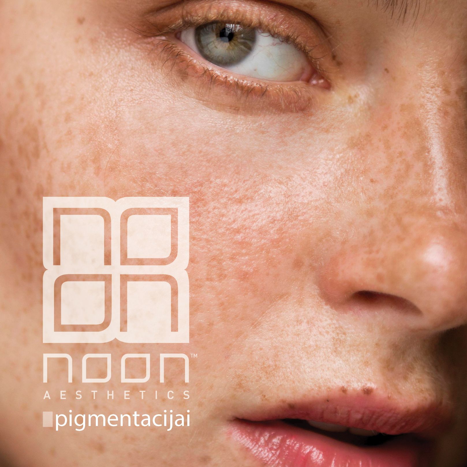 NOON™ Aesthetics odos skaistinimas: procedūra pigmentuotai odai