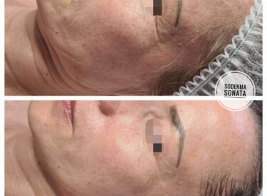 IMG-0349a1a587137554a0ced0fe65e786ac-V