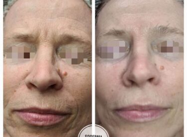 IMG-16dbff41afe78e0ecff068630c5d0e91-V