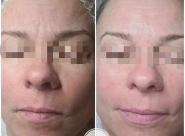 IMG-5be5f5826e999e76963a98a7b2006a46-V