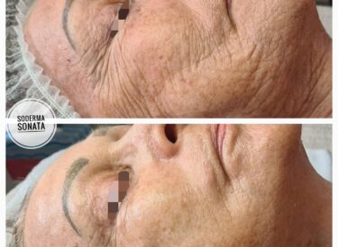 IMG-622119010cc047a097e2ed0e3a4a2d89-V