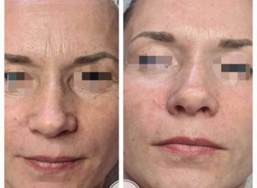 IMG-64dd35beedd9fa35ef3a6770e1d227ff-V