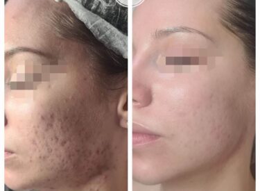 IMG-6514e211ecbaa434e995d9d06febd8c9-V