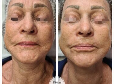 IMG-69dd29c83406ef355e7a5e54c72affb8-V