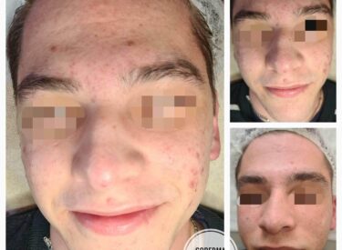 IMG-6cad132f2860583549f5779c39aa9967-V