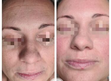 IMG-7cb092634863ed0476bf424889d03577-V