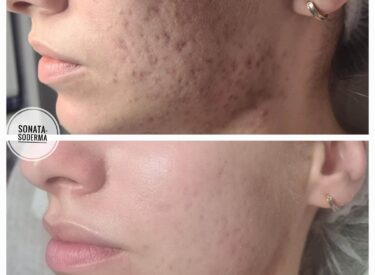 IMG-7f05105047af47d19d68b8024289e0f2-V