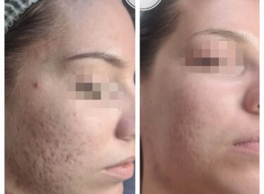 IMG-7f4f2ce881c8367e7ae8e10d6e73dd45-V (1)