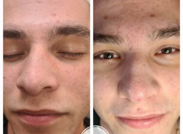 IMG-94d35270cedd65656a88e863e5932a0e-V