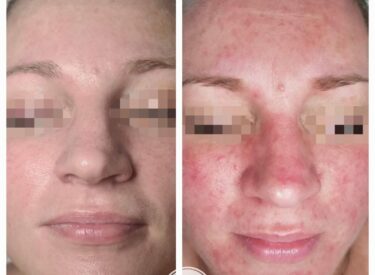 IMG-aa3497c2a301b3d9de3fcce68df54e56-V