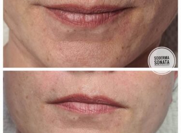 IMG-c9a01914affe3e64ec32ba3f402948c8-V