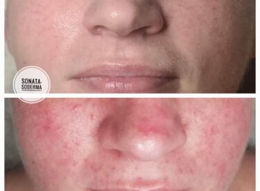 IMG-cec618abdc257aaac3d1eb43e92e59db-V