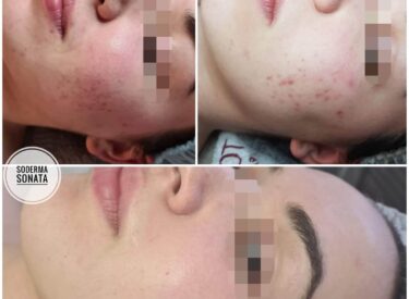 IMG-cee27c144725ed2580c9adce99081db5-V