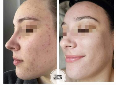 IMG-06a114b6c72bdf1fd3f43f5546a027ce-V