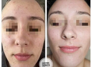 IMG-4826aaa5ac74dc69decbce9f320d3c2b-V