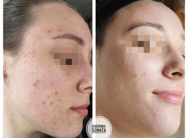 IMG-76b01526f802ff112a532bd3716f0205-V