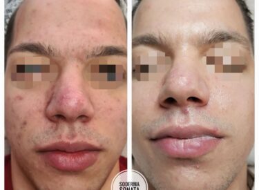 IMG-b43ad734bd81282fca2668ce57edc3be-V