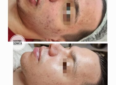 IMG-eea309d3da3736a82971209dd9a3ebdb-V