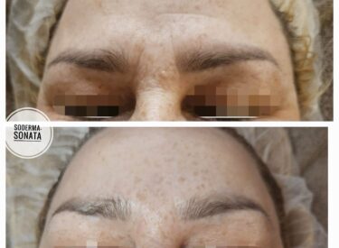 IMG-3ce5e767e1d34b93fa29c17ecd48ccaa-V