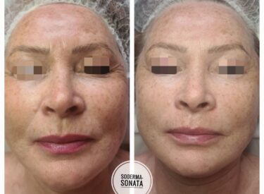 IMG-877ab2ca14c6aa62aba506820306bade-V