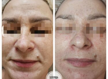 IMG-ff29232bc6551d1b5276fe69c0a140ff-V