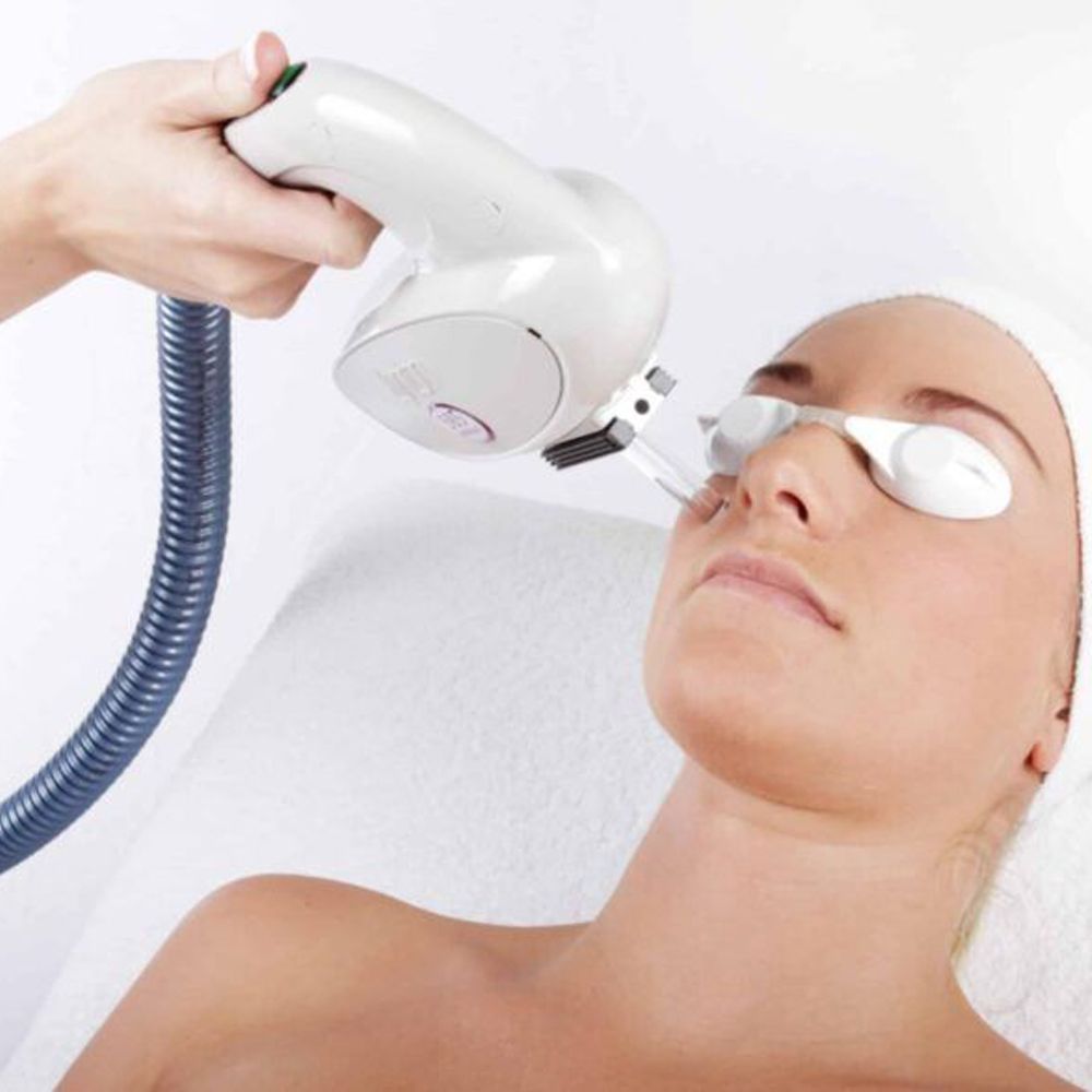 Plaukelių šalinimas pažangiu IPL Dermaliux lazeriu