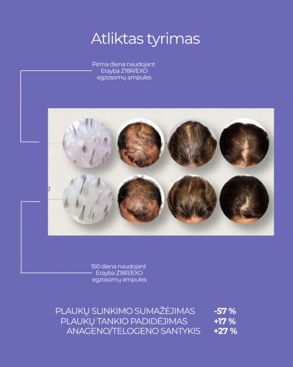 Erayba, Zen Active, intensyvaus veikimo ampulės nuo plaukų slinkimo su egzosomomis, 5 x 15ml. - Image 2