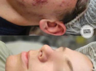1000130745